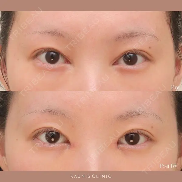 KAUNIS CLINIC（カウニスクリニック）の症例