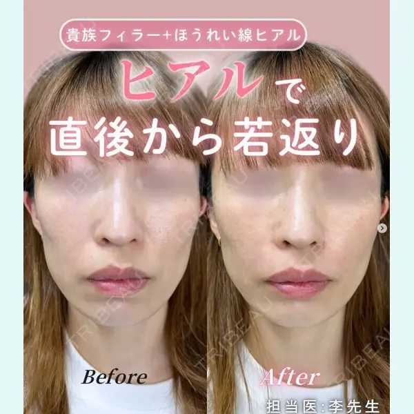 ルラ美容クリニック 神戸院の症例