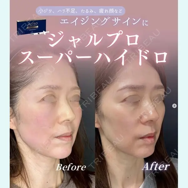 ルラ美容クリニック 神戸院の症例