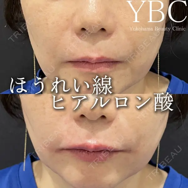YBC横浜美容外科 立川院 大島 諒士医師の症例