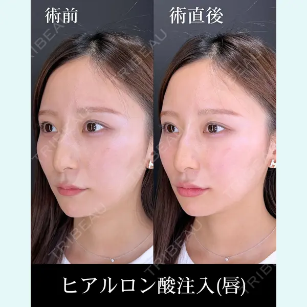 HAAB×DREAM BEAUTY CLINIC 大阪梅田院 柏木 太雅医師の症例