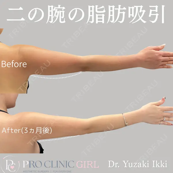 PRO CLINIC プロクリニック 銀座院 柚﨑 一輝医師の症例