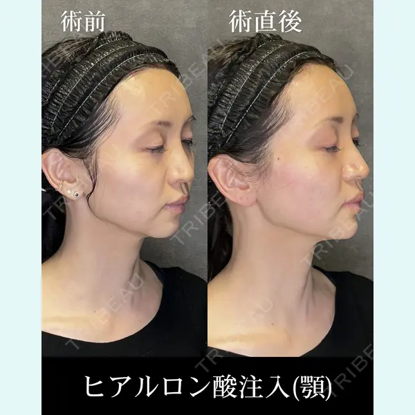 HAAB CLINIC 福岡院 米谷 拓朗医師の症例