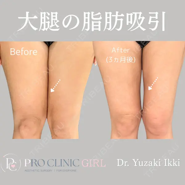 PRO CLINIC プロクリニック 銀座院 柚﨑 一輝医師の症例