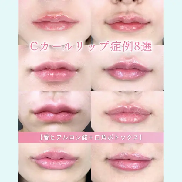 ルラ美容クリニック 新潟院 菊地 泰正医師の症例
