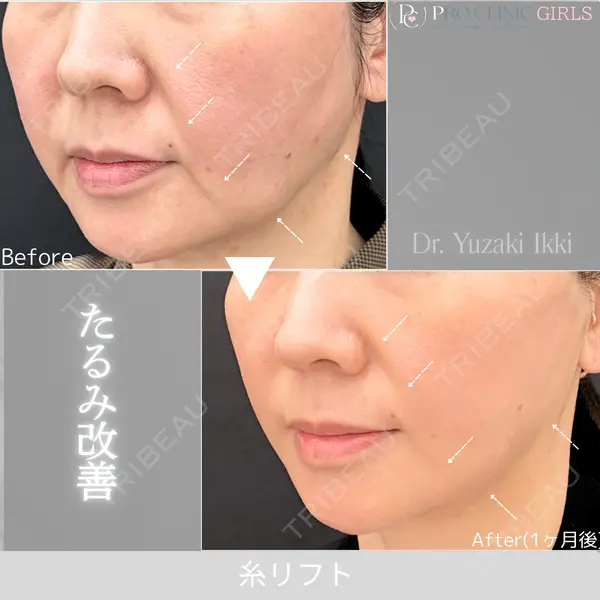PRO CLINIC プロクリニック 銀座院の症例