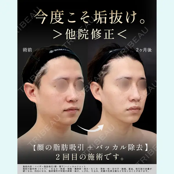 WOM CLINIC GINZA （ワム クリニック ギンザ） 淺川 雅道医師の症例