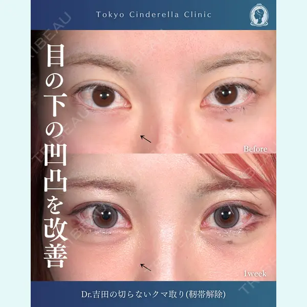 東京シンデレラ美容外科  横浜院 吉田 利之医師の症例