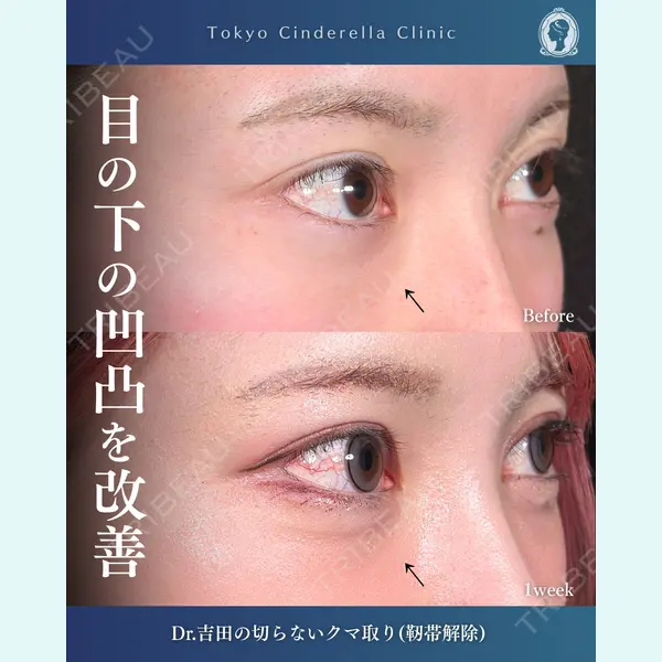 東京シンデレラ美容外科  横浜院 吉田 利之医師の症例