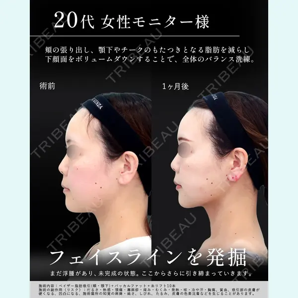WOM CLINIC GINZA （ワム クリニック ギンザ） 淺川 雅道医師の症例