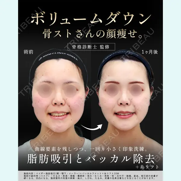 WOM CLINIC GINZA （ワム クリニック ギンザ） 淺川 雅道医師の症例