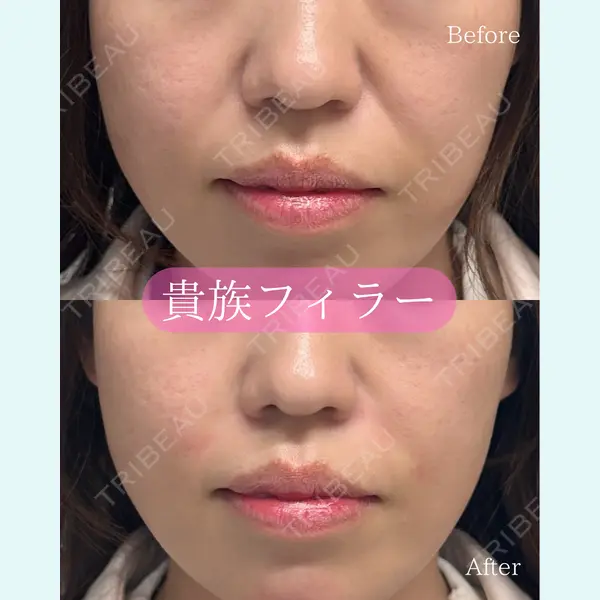 ルラ美容クリニック 郡山院の症例