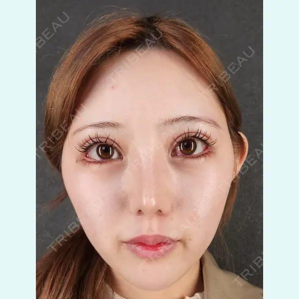 Tokyo Tensei Clinic 新宿院 辻 大成医師の症例