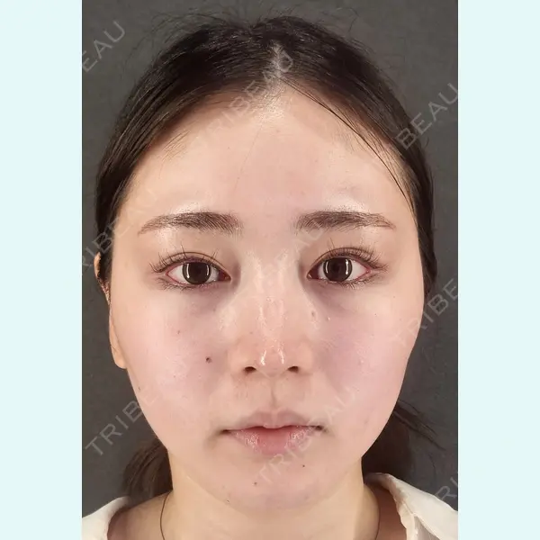 Tokyo Tensei Clinic 新宿院 辻 大成医師の症例
