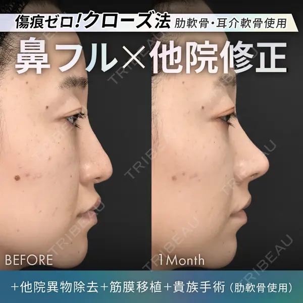 ジョウクリニック 銀座院 重本　譲医師の症例