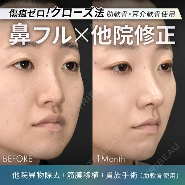 ジョウクリニック 銀座院 重本　譲医師の症例