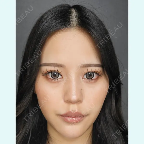 Tokyo Tensei Clinic 新宿院 辻 大成医師の症例