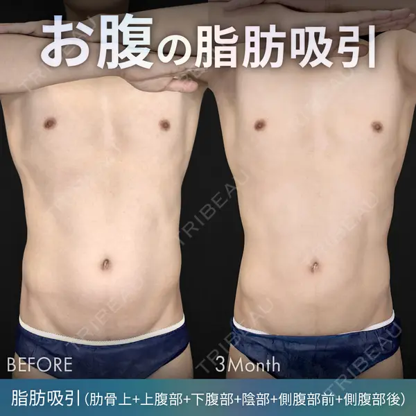 ジョウクリニック 銀座院 重本　譲医師の症例