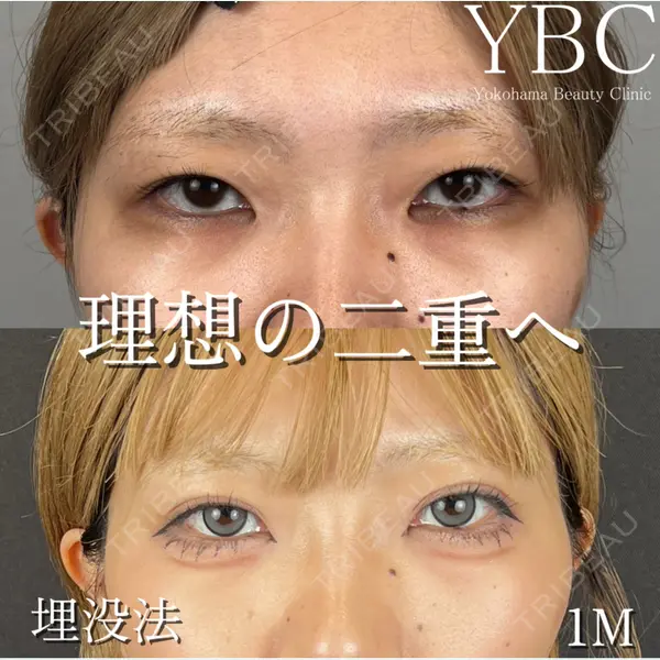 YBC横浜美容外科 立川院 大島 諒士医師の症例
