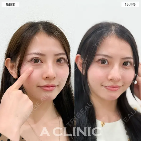 A CLINIC（エークリニック） 仙台院 伊藤 瑠桂医師の症例