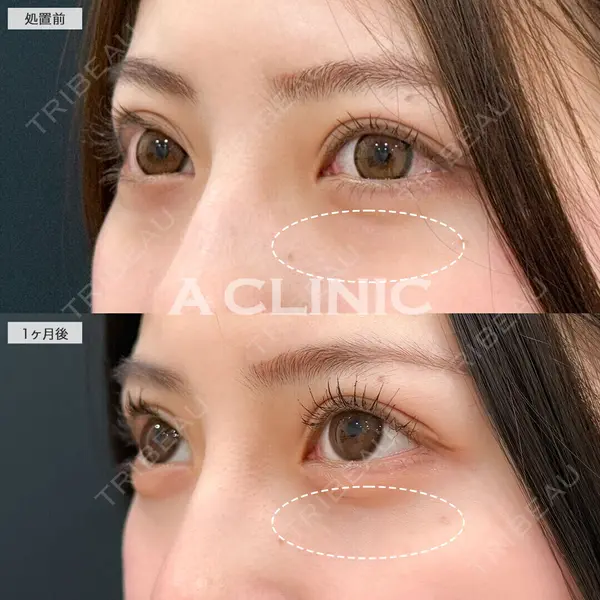 A CLINIC（エークリニック） 仙台院 伊藤 瑠桂医師の症例