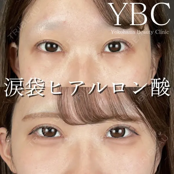 YBC横浜美容外科 立川院 大島 諒士医師の症例