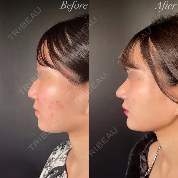 R Beauty CLINIC 銀座院 吉田　慧医師の症例