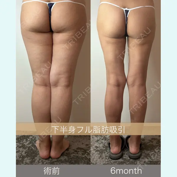 GAYA body design clinic 飯ヶ谷 重来医師の症例