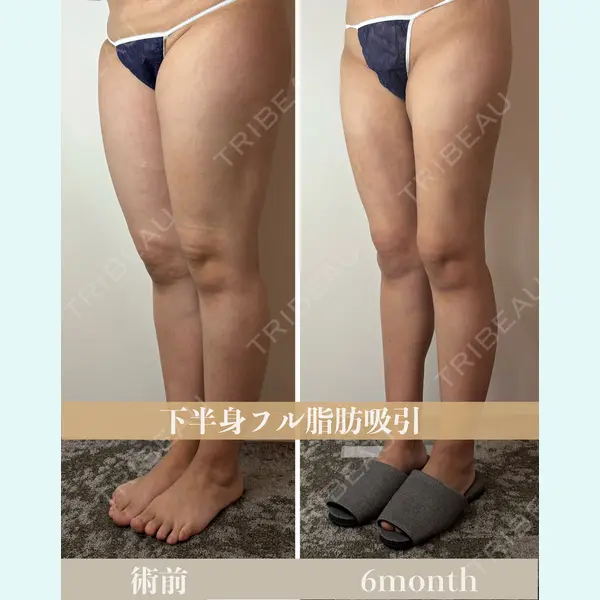 GAYA body design clinicの症例