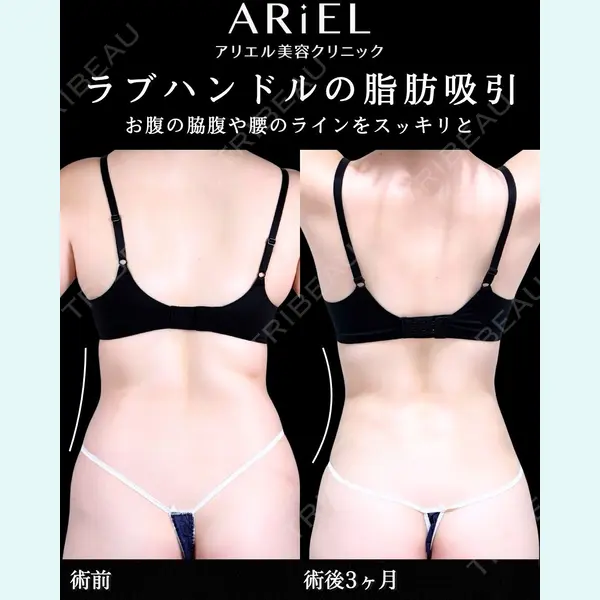 アリエル美容クリニック 横浜院 加藤 敏次医師の症例