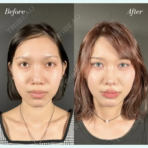 R Beauty CLINIC 名古屋院 木村 尚大医師の症例