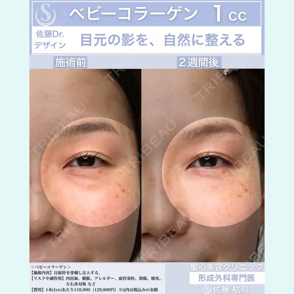 聖心美容クリニック 六本木院 佐藤 航司医師の症例