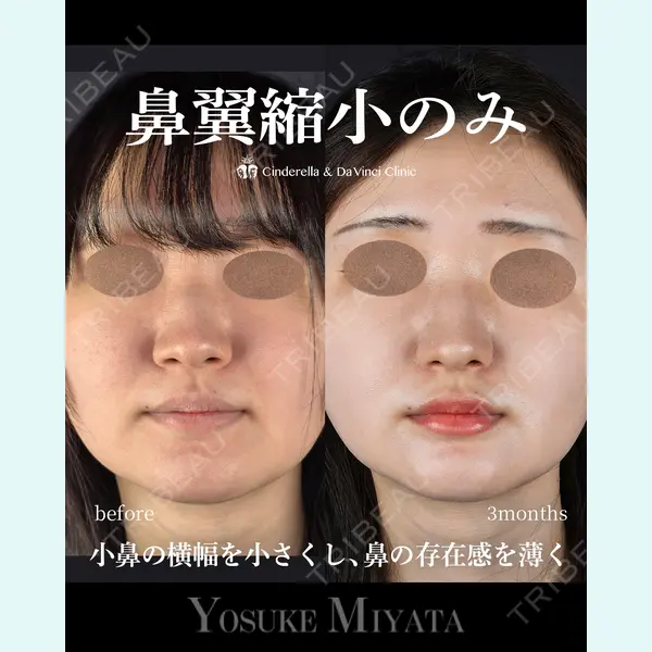 シンデレラ＆ダヴィンチクリニック 宮田 洋佑医師の症例