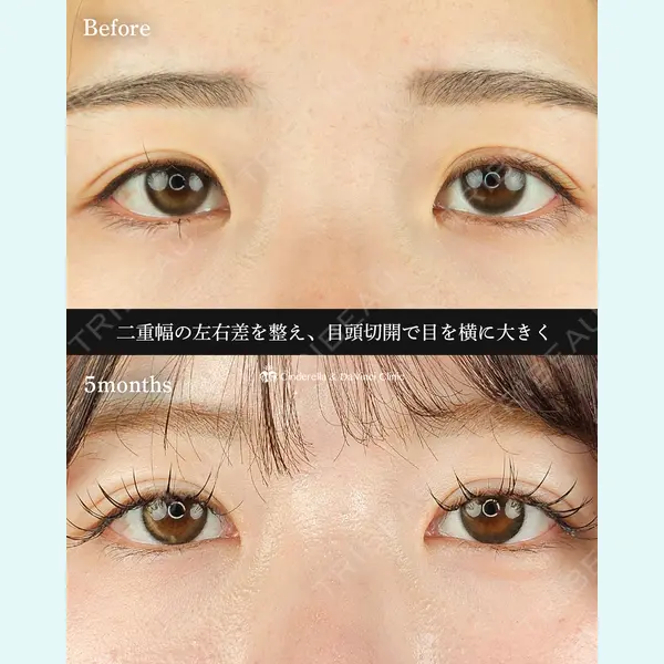 シンデレラ＆ダヴィンチクリニック 佐藤 博文医師の症例