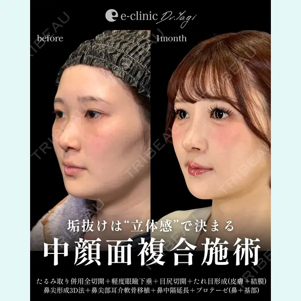 eクリニック 大阪院 八木 良太医師の症例