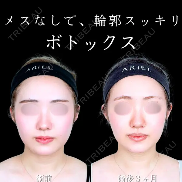 アリエル美容クリニック 水戸院の症例