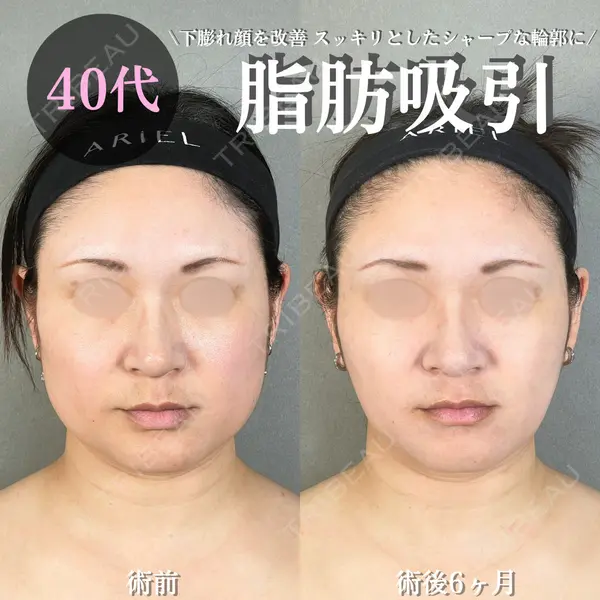 アリエル美容クリニック 大宮院 鈴木　桂介医師の症例