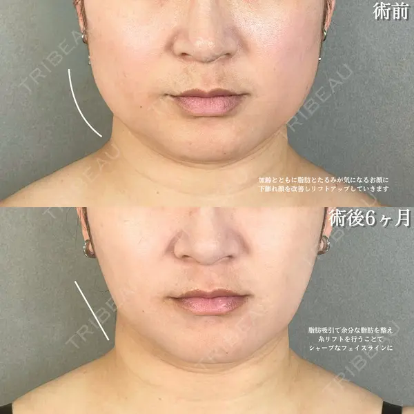 アリエル美容クリニック 大宮院 鈴木　桂介医師の症例