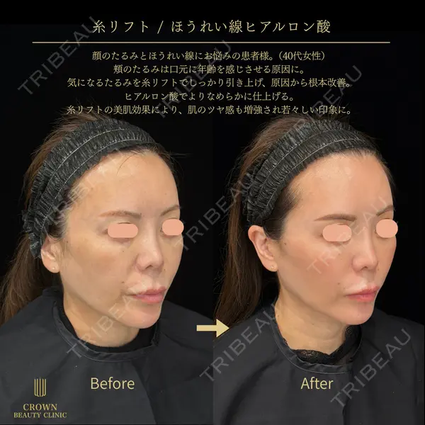 CROWN BEAUTY CLINIC 神山 豊医師の症例