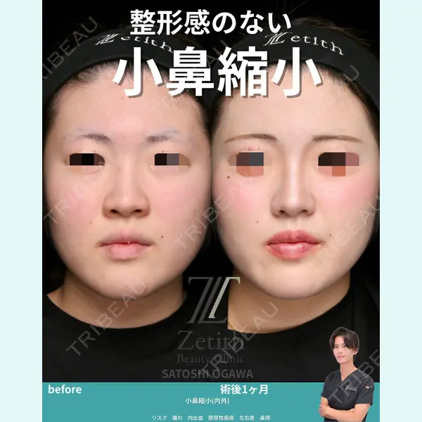 Zetith Beauty Clinic 銀座院 小川 悟史医師の症例