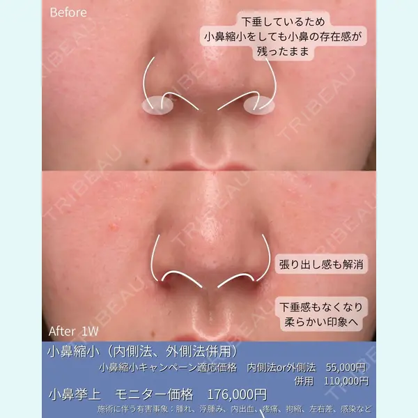 Zetith Beauty Clinic 銀座院 守屋 亜妃医師の症例