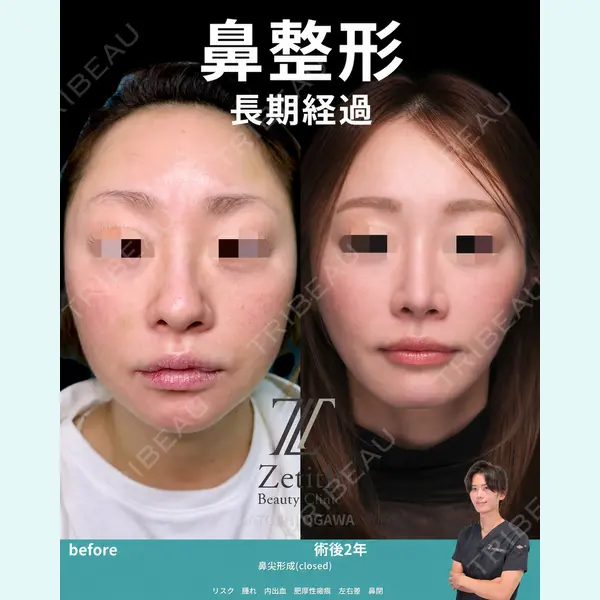 Zetith Beauty Clinic 銀座院 小川 悟史医師の症例