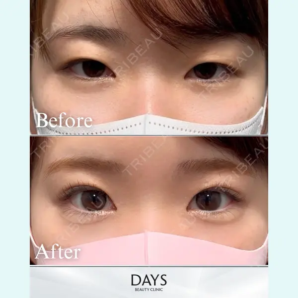Days Beauty Clinic 本厚木院の症例