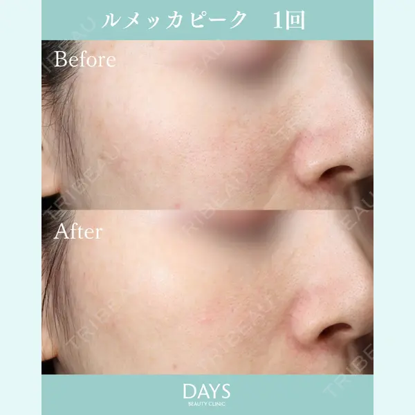DaysBeautyClinic 銀座院の症例
