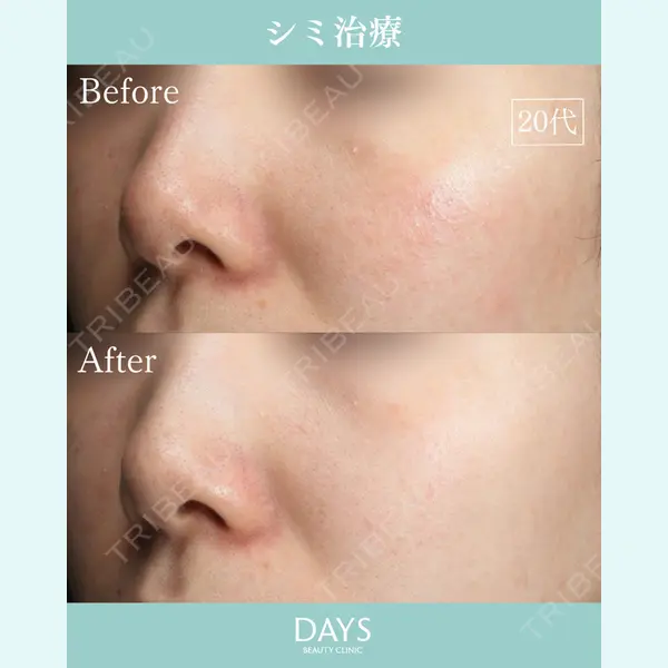 DaysBeautyClinic 銀座院の症例