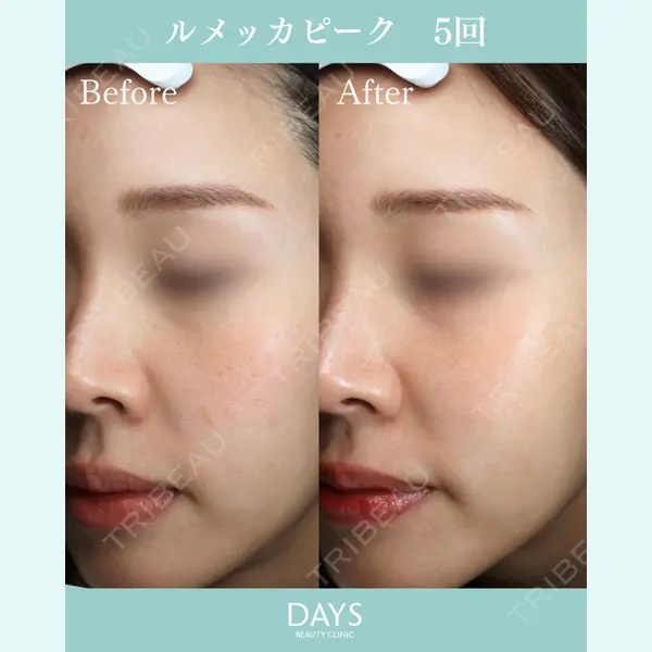 DaysBeautyClinic 銀座院の症例
