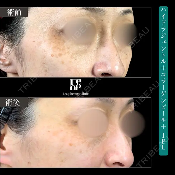 Leap beauty clinic 土門 駿也医師の症例