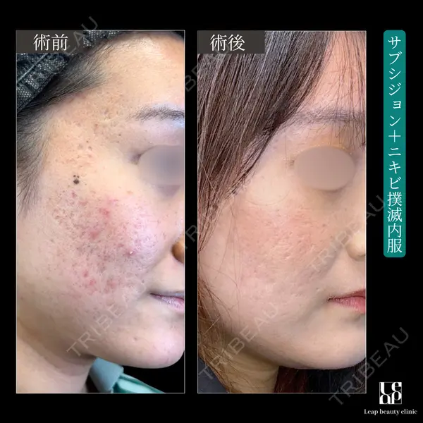 Leap beauty clinicの症例