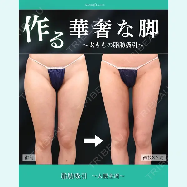 ガーデンクリニック 名古屋院 安立 弘太医師の症例