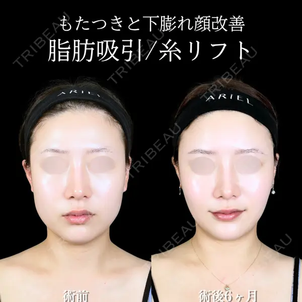 アリエル美容クリニック 大宮院 鈴木　桂介医師の症例